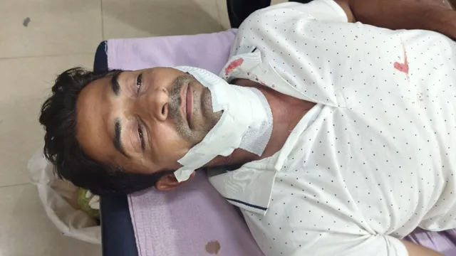 रक्षाबंधन पर पतंगबाजी का शौक बना आफत! जम्मू में गट्टु डोर ने काटे गले-उंगलियां, कई लोग अस्पताल पहुंचे