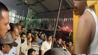 छेड़खानी की घटना को लेकर थाने में जुटे लोग और लाठी चार्ज में घायल युवक। (फोटो जागरण)