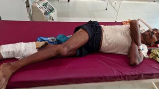मुंगेर सदर अस्पताल में इलाज की बदहाली