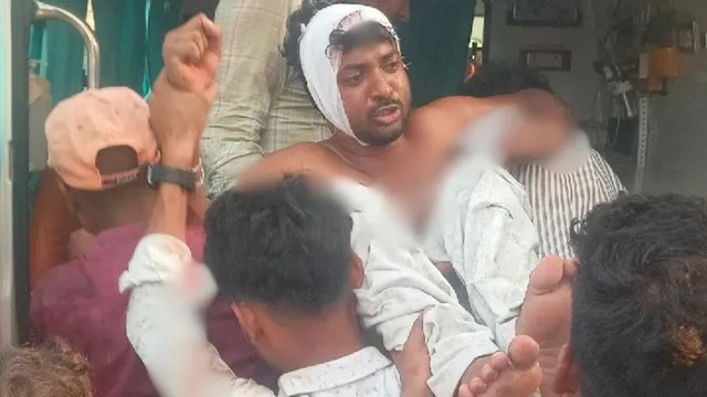 कुशीनगर में डोल मेला में हुड़दंग, पुलिस की लाठियों से युवक का फटा सिर
