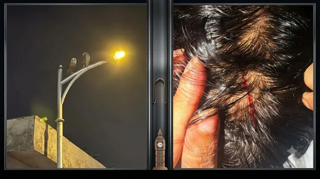 उल्लुओं के हमले से खौफ में ग्रेटर नोएडा की सोसायटी, शाम होते ही घरों में कैद हो जाते हैं लोग