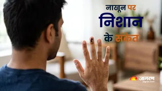 नाखूनों पर काले धब्बे का रहस्य । (Picture Credit- AI Generated)