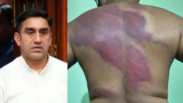 दिल्ली में भाजपा विधायक पर पार्टी कार्यकर्ता ने ही लगवाया SC/ST, शटर बंद कर बेल्ट और पाइप से पीटा 
