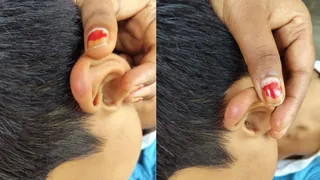 बच्चे के काम पर चोट के निशान