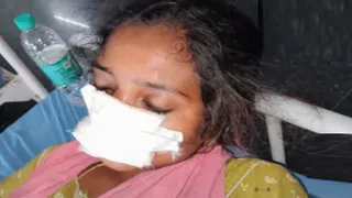 तेलंगाना: पत्नी ने घर लौटने से इनकार किया तो पति ने काट दिया नाक (फोटो- सोशल मीडिया)