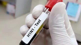 हिसार में स्वाइन फ्लू का कहर जारी (फाइल फोटो)