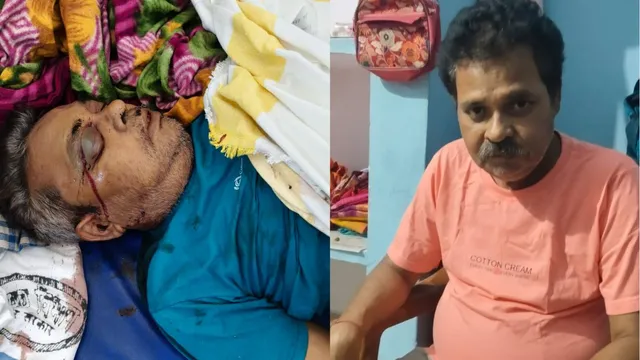 चेहरे से रिसते खून और डॉक्टर की लापरवाही ने ली नटवर की जान; भागलपुर जेल के बंंदी की मौत पर बिलख पड़ा परिवार