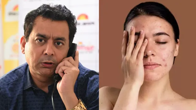 युवाओं में तेजी से बढ़ रही बाल झड़ने और त्वचा की समस्या, PMCH के डॉक्टर ने बताया क्या करें-क्या न करें