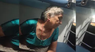 कानबाली झपटने के दौरान महिला के कान का निचला हिस्सा कटा। (फोटो सौजन्य)