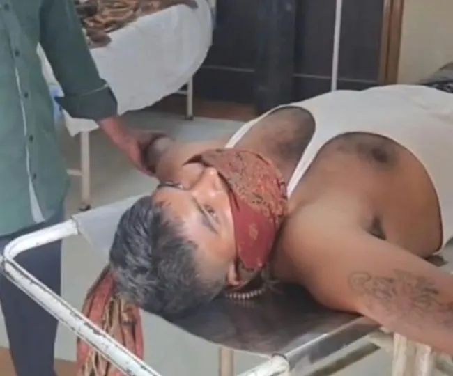 hathras dog bit men