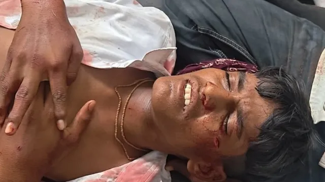 अमरोहा: ‘चाबी लेनी है…’ बोलकर स्कूल से ले गया जीजा, फिर 15 साल के साले को चाकुओं से गोदा.. अमरोहा: ‘चाबी लेनी है…’ बोलकर स्कूल से ले गया जीजा, फिर 15 साल के साले को चाकुओं से गोदा..