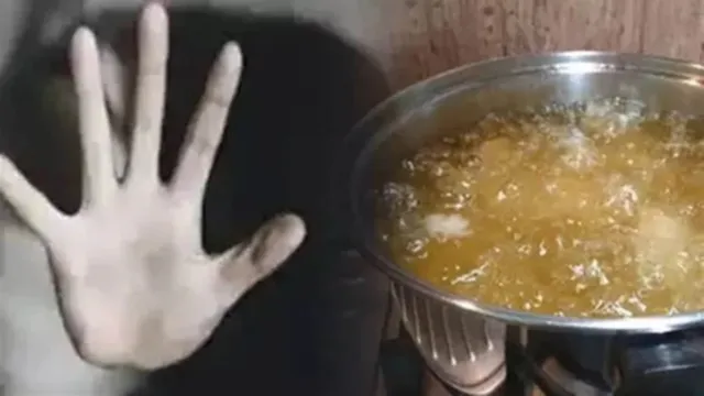 https://www.jagranimages.com/images/2026/10/05/template/image/boiling-oil-thrown-85474-1791207347514.webp