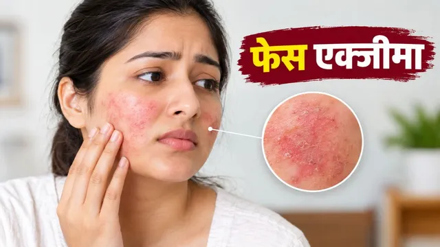 फेस एक्जीमा है, तो मेकअप लगाते समय न करें ये गलतियां, त्वचा का रखें खास ख्याल