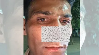 तीन युवकों ने हमला कर फौजी की नाक काट दी।