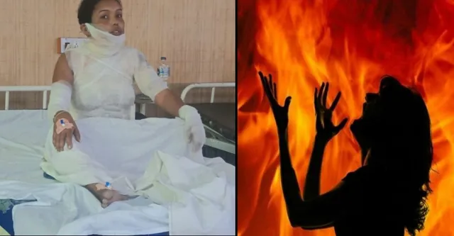 बांदा में पड़ोसी महिला पर पेट्रोल डालकर लगाई आग, नाली में कूदकर बचाई जान
