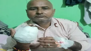 वाराणसी में चाइनीज मांझे से कटा बाइक सवार का हाथ, अस्पताल में भर्ती।