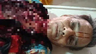 वाराणसी में चाइनीज मांझे ने ली जान, बाइक सवार का गला कटा।