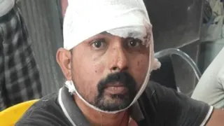 पिस्टल की बट से जख्मी मनोज कुमार।