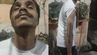 कटी गर्दन व बाजू के घाव दिखाता हुआ युवक।