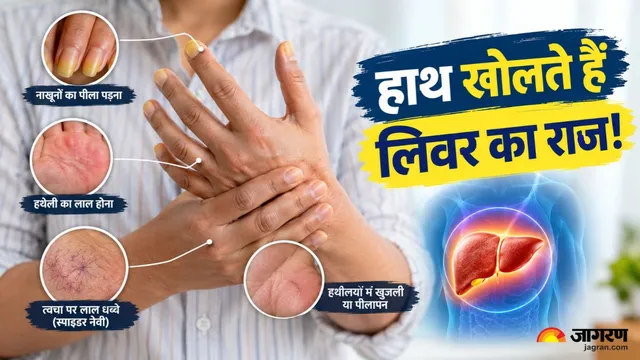 हथेलियों में दिख सकते हैं लिवर की परेशानी के संकेत, इन बदलावों को न करें नजरअंदाज