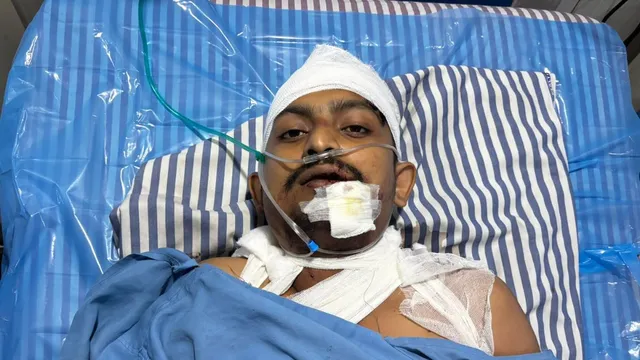 मोतिहारी में मुरादाबाद से लौट रहे बीटेक छात्र पर चाकू से जानलेवा हमला, आरोपी को तलाश रही पुलिस
