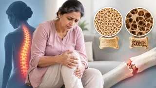 हड्डियों को अंदर से खोखला कर रही हैं 'साइलेंट किलर' (फाइल फोटो)