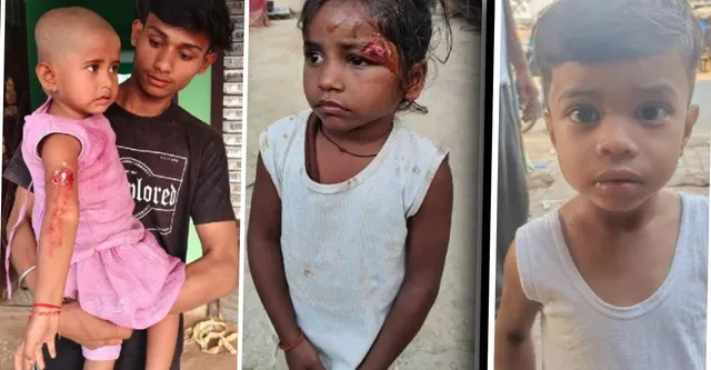 उन्नाव में स्कूल से घर लौट रहे 6 बच्चों पर पागल कुत्ते का हमला, लहूलुहान हुए मासूम, गांव में मची चीख-पुकार
