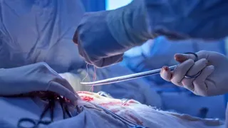 महिला के शरीर के प्रमुख अंग सामान्य स्थिति के विपरीत थे (सांकेतिक तस्वीर)