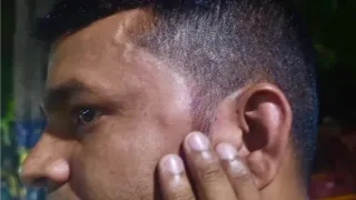 सिपाही अपनी चोट दिखाते हुए। जागरण