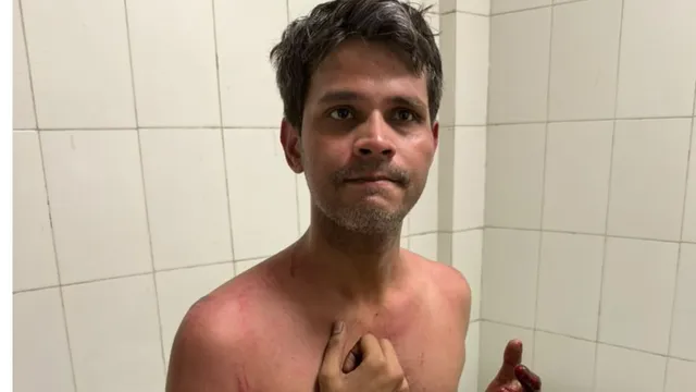 प्रयागराज में रास्ताजाम कर रहे अधिवक्ताओं ने SRN अस्पताल के डॉक्टर से मारपीट की, विरोध में ट्रामा सेंटर में काम ठप
