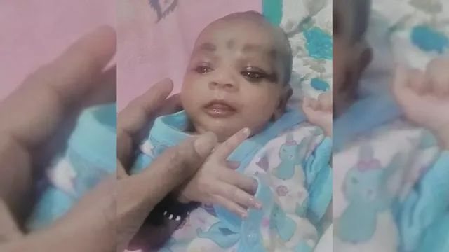 गोरखपुर में बीआरडी मेडिकल कॉलेज से एक माह की नवजात गायब, माता-पिता के बयानों में उलझी पुलिस
