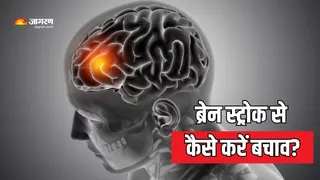 स्ट्रोक प्रिवेंशन के असरदार तरीके (Picture Courtesy: Freepik)