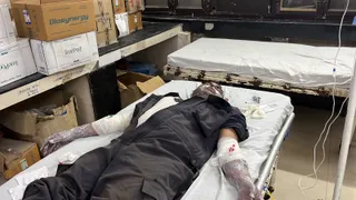 आग बुझाने के दौरान दमकलकर्मी झुलसा।