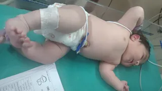 वाराणसी में जन्मा अब तक का सबसे वजनी शिशु, उच्च जोखिम वाली गर्भावस्था में मिली सफलता।