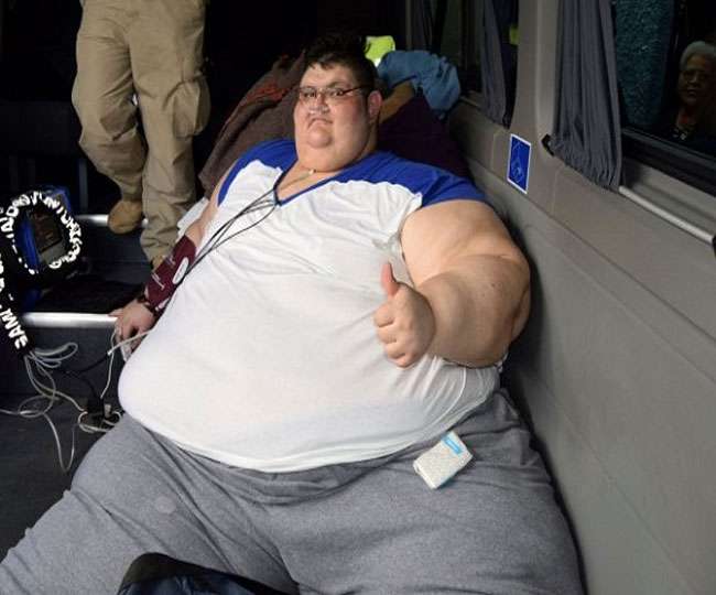 Worlds Most Obese Man Wants Medical Treatment To Lose Weight
