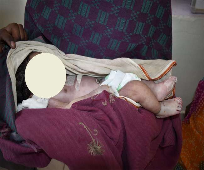 शर्मनाक: अस्पताल के ICU में नवजात को चूहे ने काटा, हो गई मौत