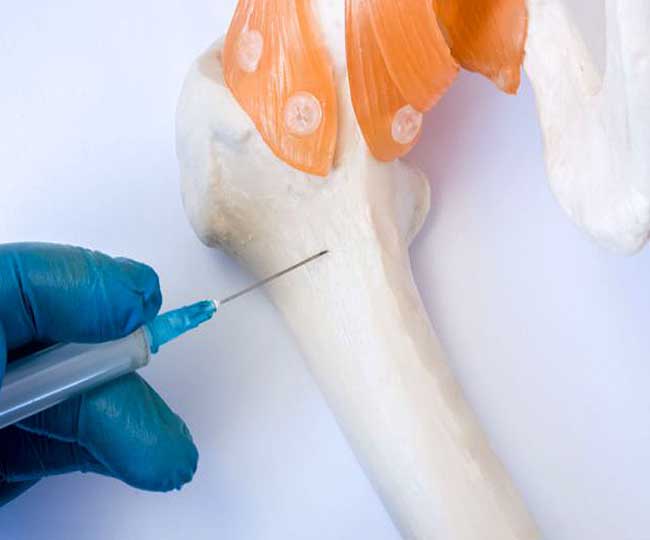 bone marrow cancer Signs symptoms and causes Jagran Special