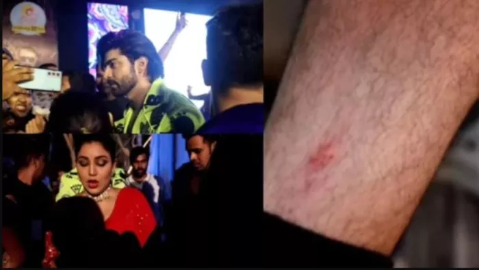 Gurmeet Choudhary Injured: गुरमीत चौधरी फिल्म कलाकार है।