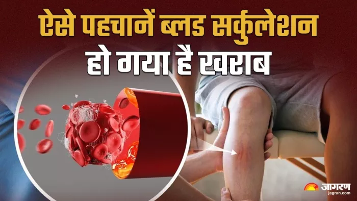 शरीर के लिए मुसीबत बन सकता है खराब ब्लड सर्कुलेशन, ऐसे करें इसकी पहचान (Image Source: Freepik)