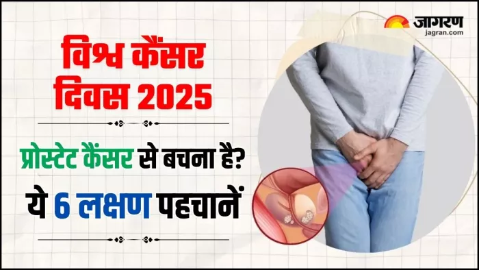 World Cancer Day 2025: प्रोस्टेट कैंसर के ये 6 संकेत जानते हैं आप? (Image Source: Jagran)