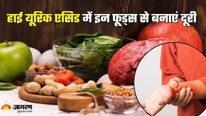यूरिक एसिड में भूलकर भी न खाएं ये फूड्स (Picture Credit- Freepik)