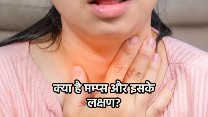Mumps Disease: क्या है मम्प्स की बीमारी. इसके लक्षण व संकेत
