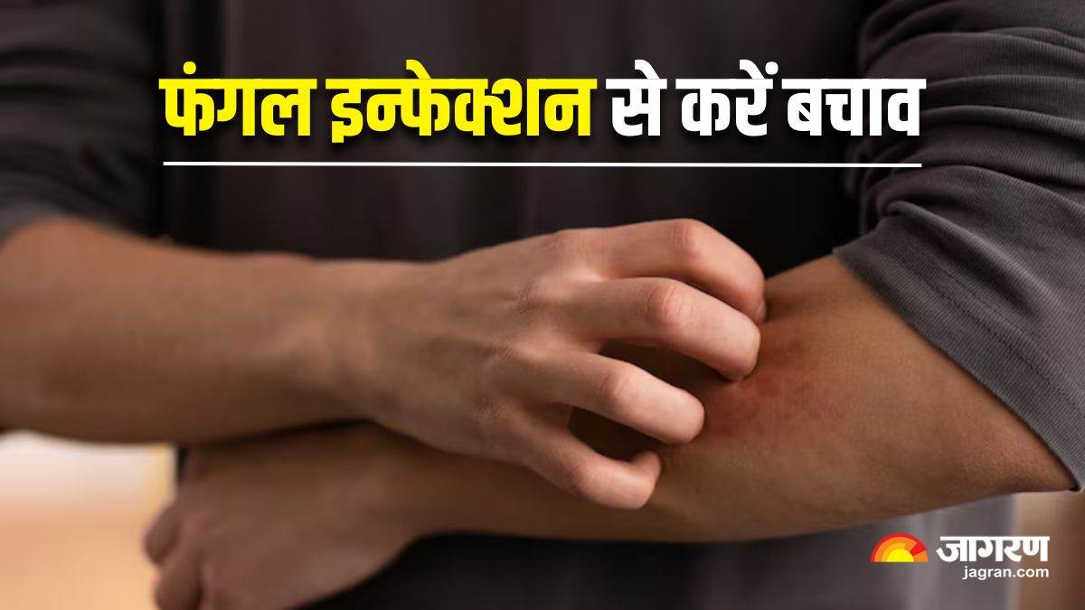 https://www.jagranimages.com/images/newimg/01062025/01_06_2025-monsoon_fungal_infection_23952998.jpg