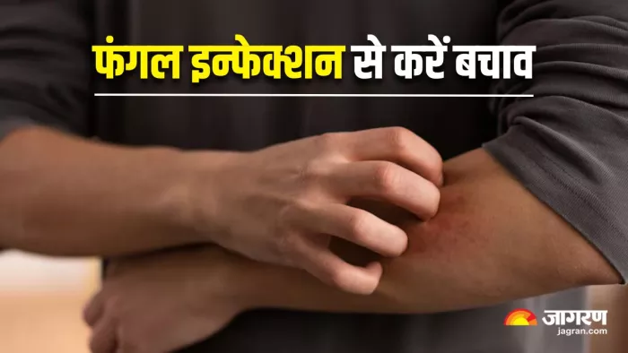 मानसून में इस तरह करें Fungal Infection से अपना बचाव (Image Source: Freepik)