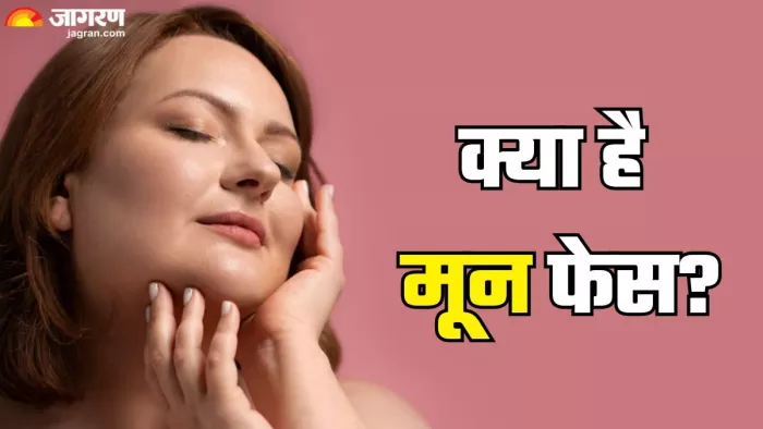 क्या मून फेस और कैसे पाएं इससे छुटकारा (Picture Credit- Freepik)