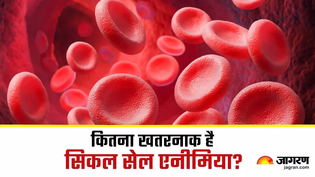 Sickle Cell Anemia बिखेर देता है पूरा परिवार; भोजनपानी और हवा से नहीं