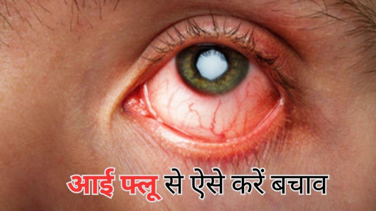 https://www.jagranimages.com/images/newimg/01082023/01_08_2023-eye-flu_1_23488195.jpg