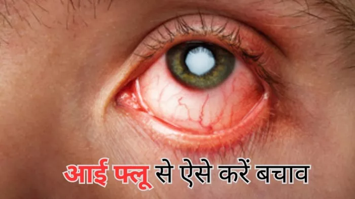 दिल्ली-एनसीआर में बढ़ रहे आई फ्लू और हेपेटाइसिस के मामले