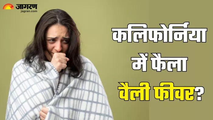 क्या है वैली फीवर और इसके लक्षण (Picture Credit- Freepik)
