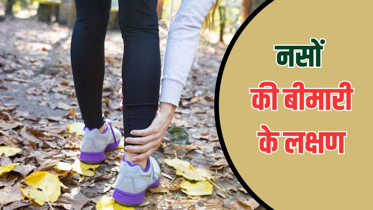https://www.jagranimages.com/images/newimg/01082025/01_08_2025-veins_disease_symptoms_23999316.jpg